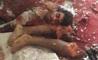 جنازه متلاشی شده عامل انتحاری مسجد شیعیان قطیف + تصاویر(۱۸+ )