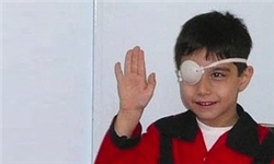 آغاز اجرای طرح ملی غربالگری تنبلی چشم برای کودکان ۳ تا ۶ سال