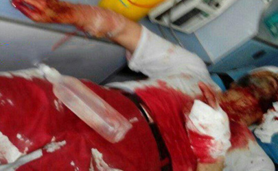 روحانی امر به معروف در ایستگاه مترو شهرری زخمی شد/ جوان ضارب بر اثر تیراندازی پلیس کشته شد+ جزئیات